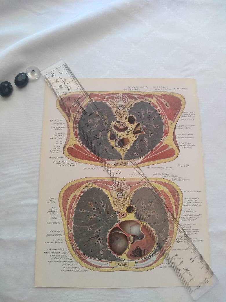 Horizontal Vertical Abdomen Diagram Dissection Anatomy Drawing Vintage ...
