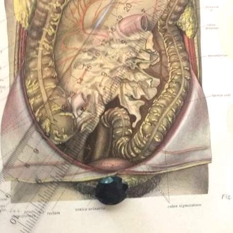 Colon and Other Bit Diagram Dissection Anatomy Drawing Vintage Medical ...