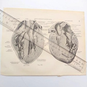 Herz Querschnitt Diagramm Dissektion Anatomie Zeichnung Vintage Medizinische Lehrbuch Druck Illustration 1936 Antike Sammlerstück Original Buch