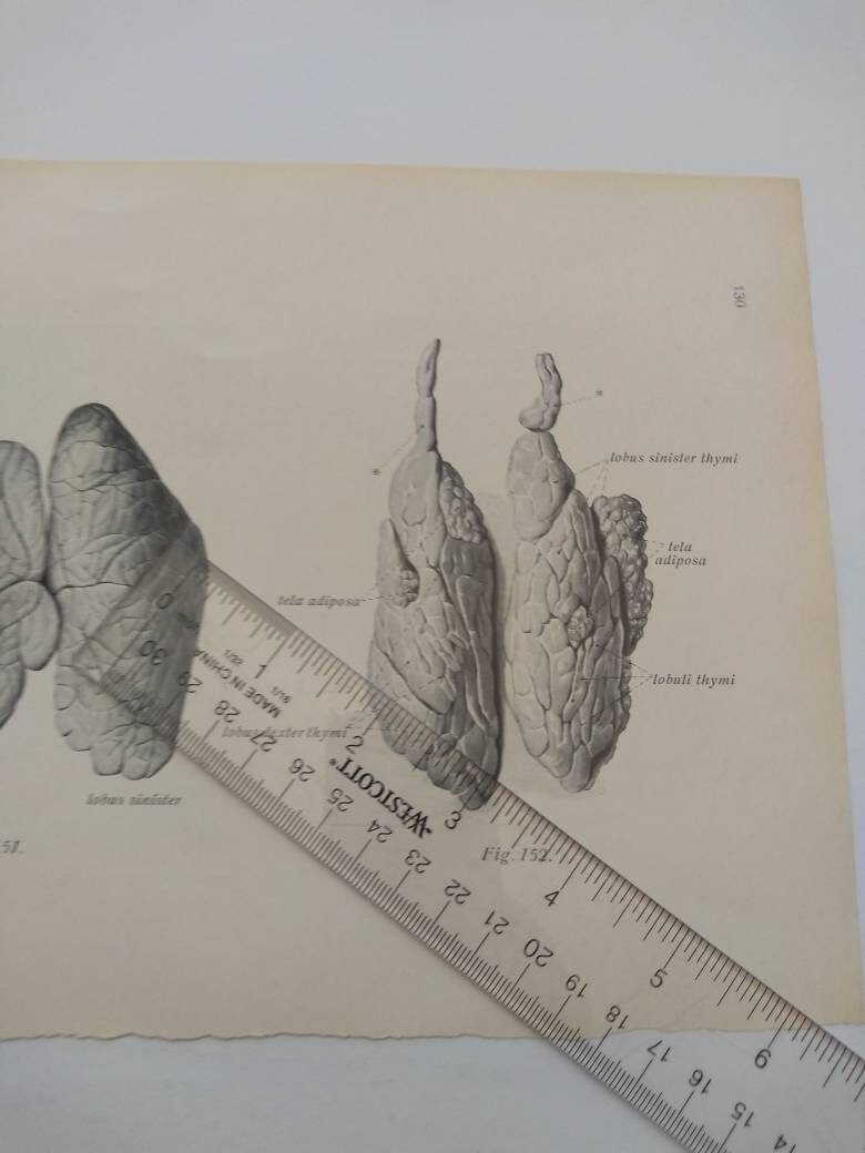 Lungs Cross Section Diagram Dissection Anatomy Drawing Vintage - Etsy