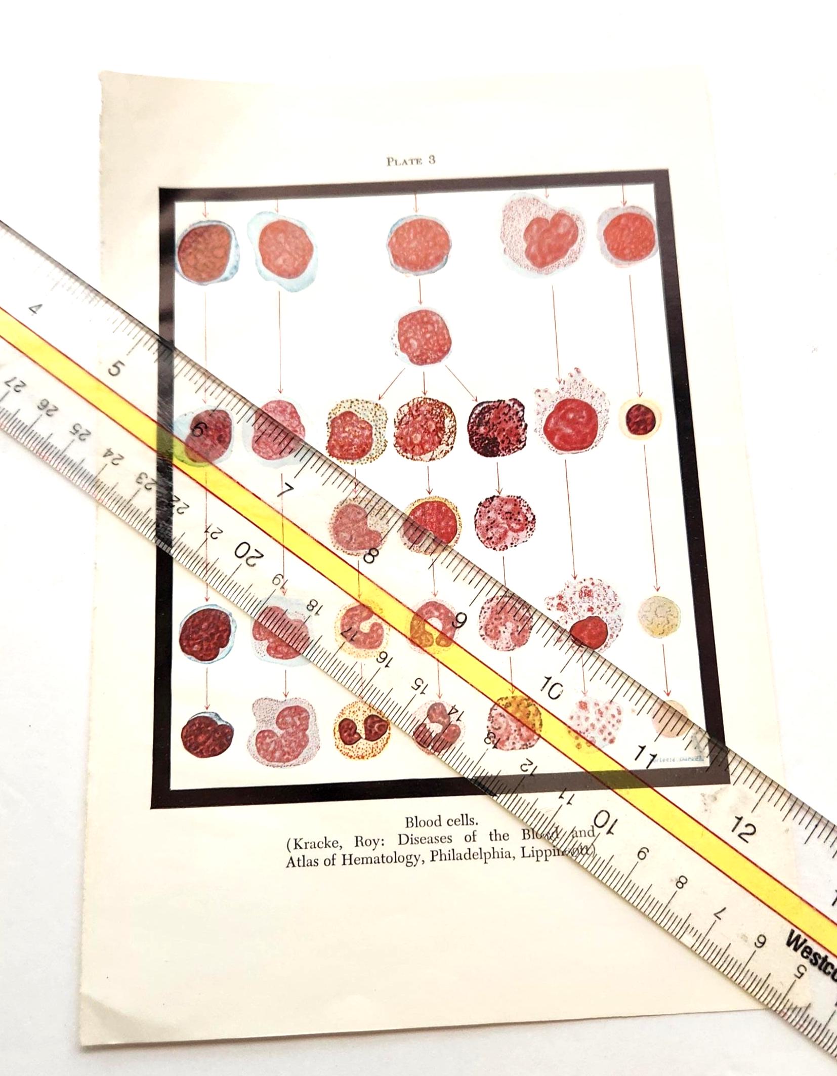 Blood Cells Diagram Dissection Anatomy Drawing Vintage Medical Textbook ...