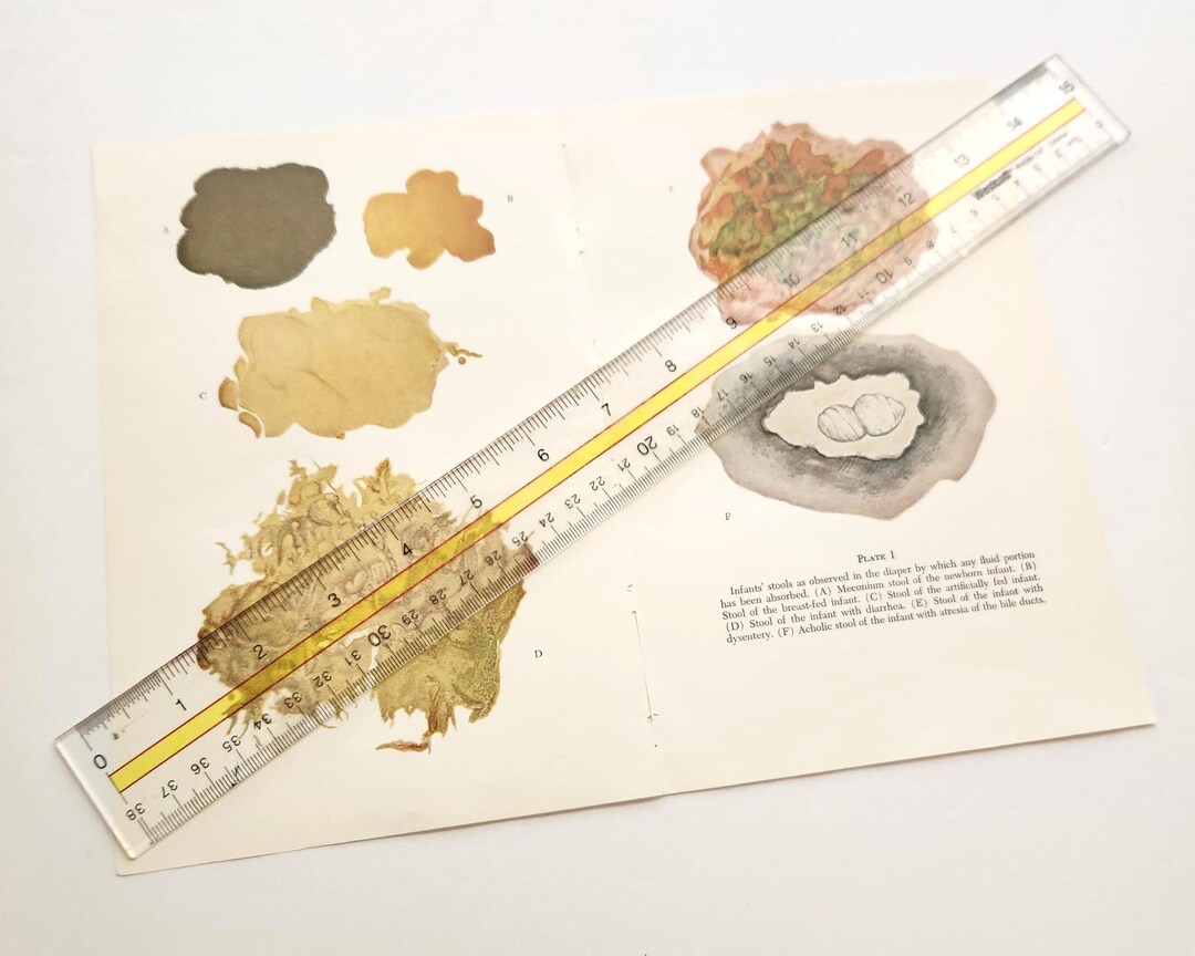 Infant's Stool Diagram Dissection Anatomy Drawing Vintage Medical ...