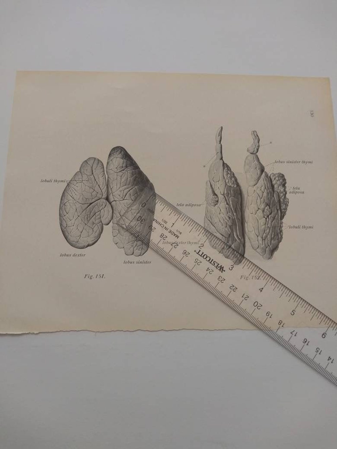 Lungs Cross Section Diagram Dissection Anatomy Drawing Vintage Medical ...