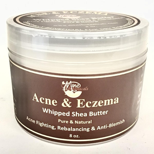 Acne & Eczema Whipped Shea Butter