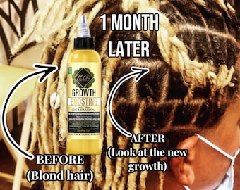 Aceite orgánico para trenzas y raíces que estimula el crecimiento del cabello. Aceite para el crecimiento del cabello, hongos en el cuero cabelludo, cuidado protector del peinado.