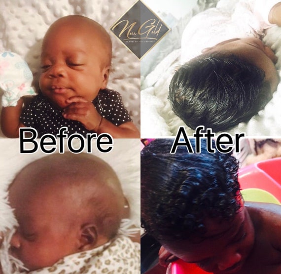 Organic BABY/Children Hair Growth Boosting Oil. Cradle Cap, Baby Hair Growth Oil, Scalp Eczema. ALL ORGANIC!