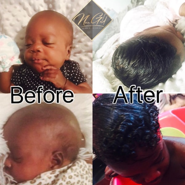 Organic BABY/Children Hair Growth Boosting Oil. Cradle Cap, Baby Hair Growth Oil, Scalp Eczema. ALL ORGANIC!