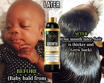 Acondicionador sin enjuague desenredante para el crecimiento del cabello de bebés y niños, de ORGANIC BEBÉS/NIÑOS. Costra láctea, crecimiento del cabello del bebé, eccema del cuero cabelludo y hongos en el cuero cabelludo.