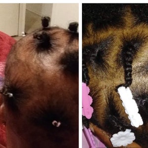 Puede incluir: Dos im&aacute;genes que muestran un primer plano de la cabeza de un ni&ntilde;o con el pelo peinado en trenzas peque&ntilde;as. La primera imagen muestra las trenzas atadas con cintas para el pelo rosas. La segunda imagen muestra las trenzas atadas con cintas para el pelo blancas y rosas.