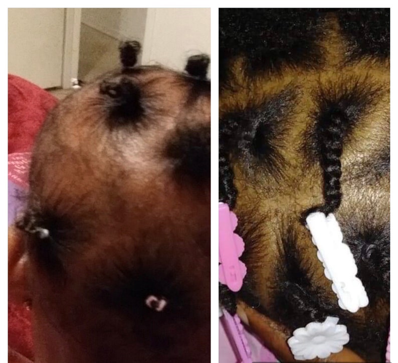 Puede incluir: Dos im&aacute;genes que muestran un primer plano de la cabeza de un ni&ntilde;o con el pelo peinado en trenzas peque&ntilde;as. La primera imagen muestra las trenzas atadas con cintas para el pelo rosas. La segunda imagen muestra las trenzas atadas con cintas para el pelo blancas y rosas.