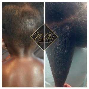 Puede incluir: Fotos de antes y despu&eacute;s que muestran el crecimiento del cabello de un ni&ntilde;o durante dos a&ntilde;os. La foto de antes muestra el cabello del ni&ntilde;o corto y delgado. La foto de despu&eacute;s muestra el cabello del ni&ntilde;o largo y saludable. El texto "Noir Gold" es visible en la imagen.