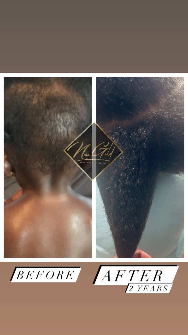 Puede incluir: Fotos de antes y despu&eacute;s que muestran el crecimiento del cabello de un ni&ntilde;o durante dos a&ntilde;os. La foto de antes muestra el cabello del ni&ntilde;o corto y delgado. La foto de despu&eacute;s muestra el cabello del ni&ntilde;o largo y saludable. El texto "Noir Gold" es visible en la imagen.