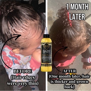 Puede incluir: Fotos de antes y despu&eacute;s del cabello de un ni&ntilde;o. La foto de antes muestra bordes de cabello finos. La foto de despu&eacute;s muestra bordes de cabello m&aacute;s gruesos despu&eacute;s de usar un aceite para cabello y cuero cabelludo etiquetado como "Baby Growth Boosting Hair & Scalp Oil". El texto "1 Month Later" es visible en la imagen.