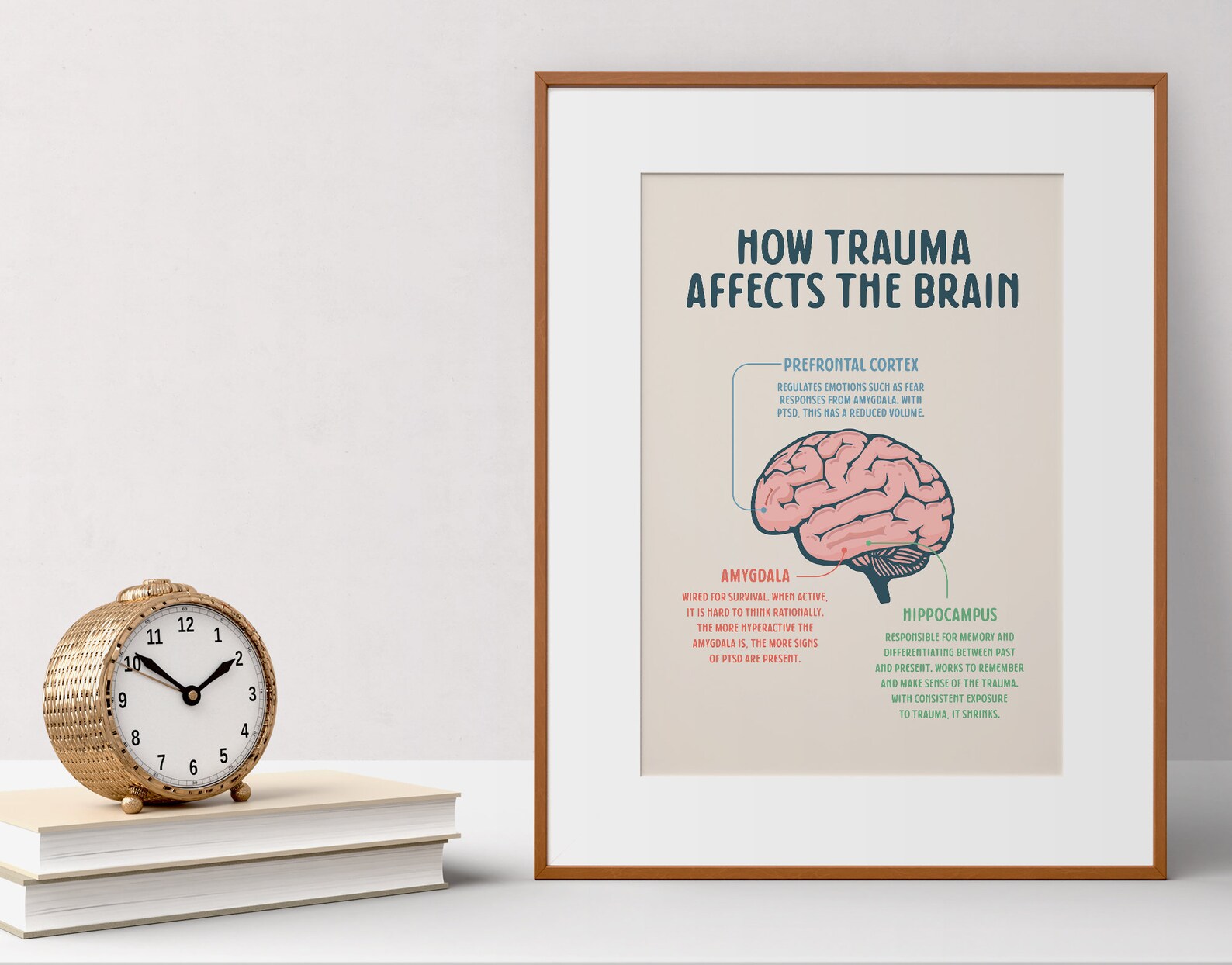 How Trauma Affects the Brain, Printable Poster, Therapy Office Decor ...