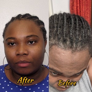 Ayurvedic Hair Fertilizer %100 Natural