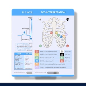 ECG Interpretation, Nursing Reference Cards, Cardiac Badge Buddy, EKG Badge Buddy, ECG Badge Card, ecg Badge Buddy, Cardiac Nurse Cards