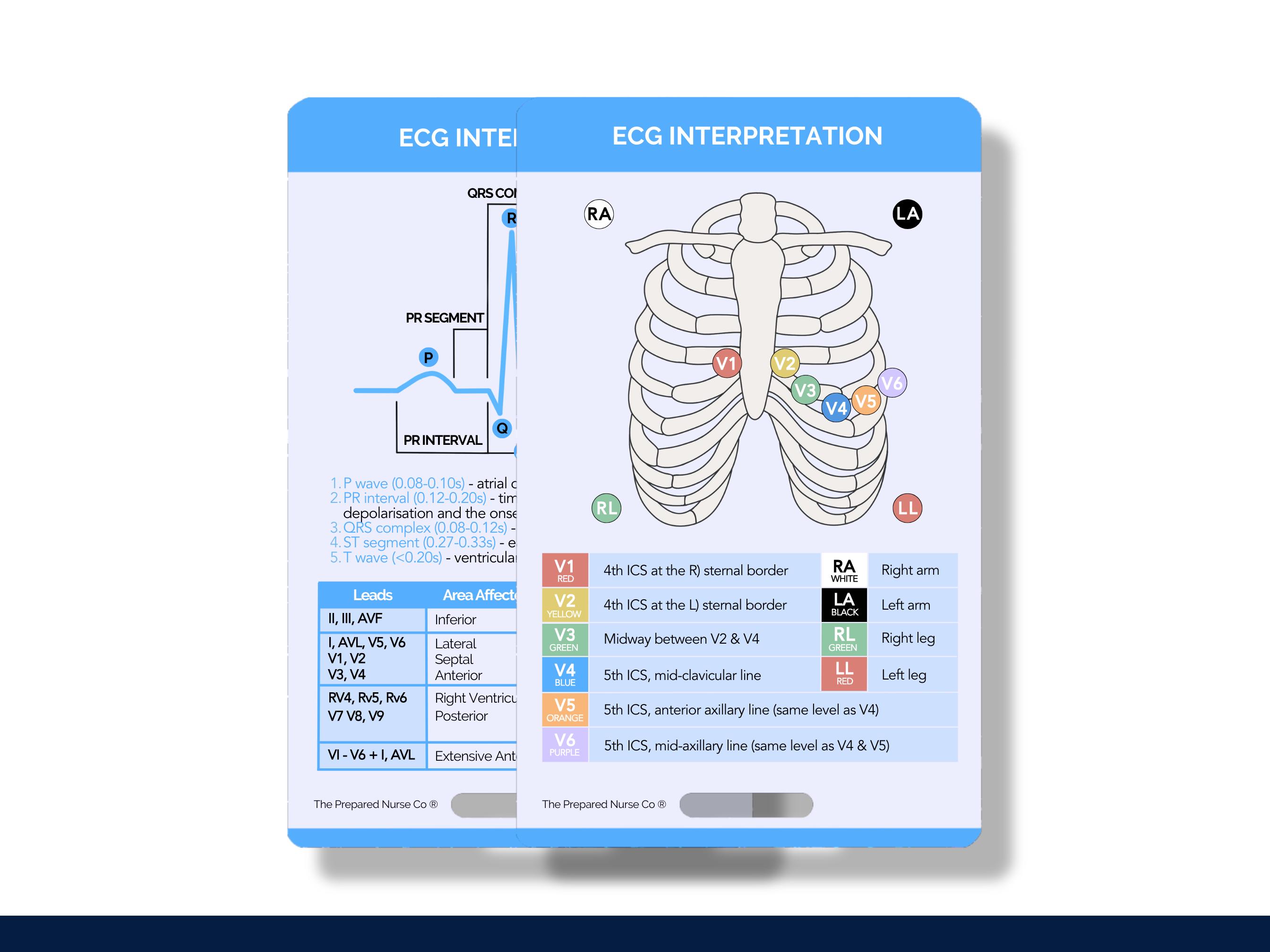 6 EKG Badge Cards, Cardiac Badge Reference  EKG Cheat Sheets PDF Tele Icu Er Nurse Card Nursing Student Emt Ems Paramedics Nursing School