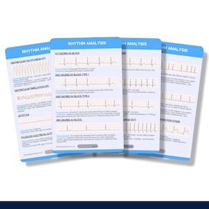 Cardiac Rhythm Analysis, Nursing Reference Cards, Cardiac Nurse Badge Buddy, ECG Badge Card, EKG Badge Buddy, Student Nurse Badge Card