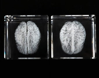 Human Brain - Set of Pial and White Matter Surface Sculptures