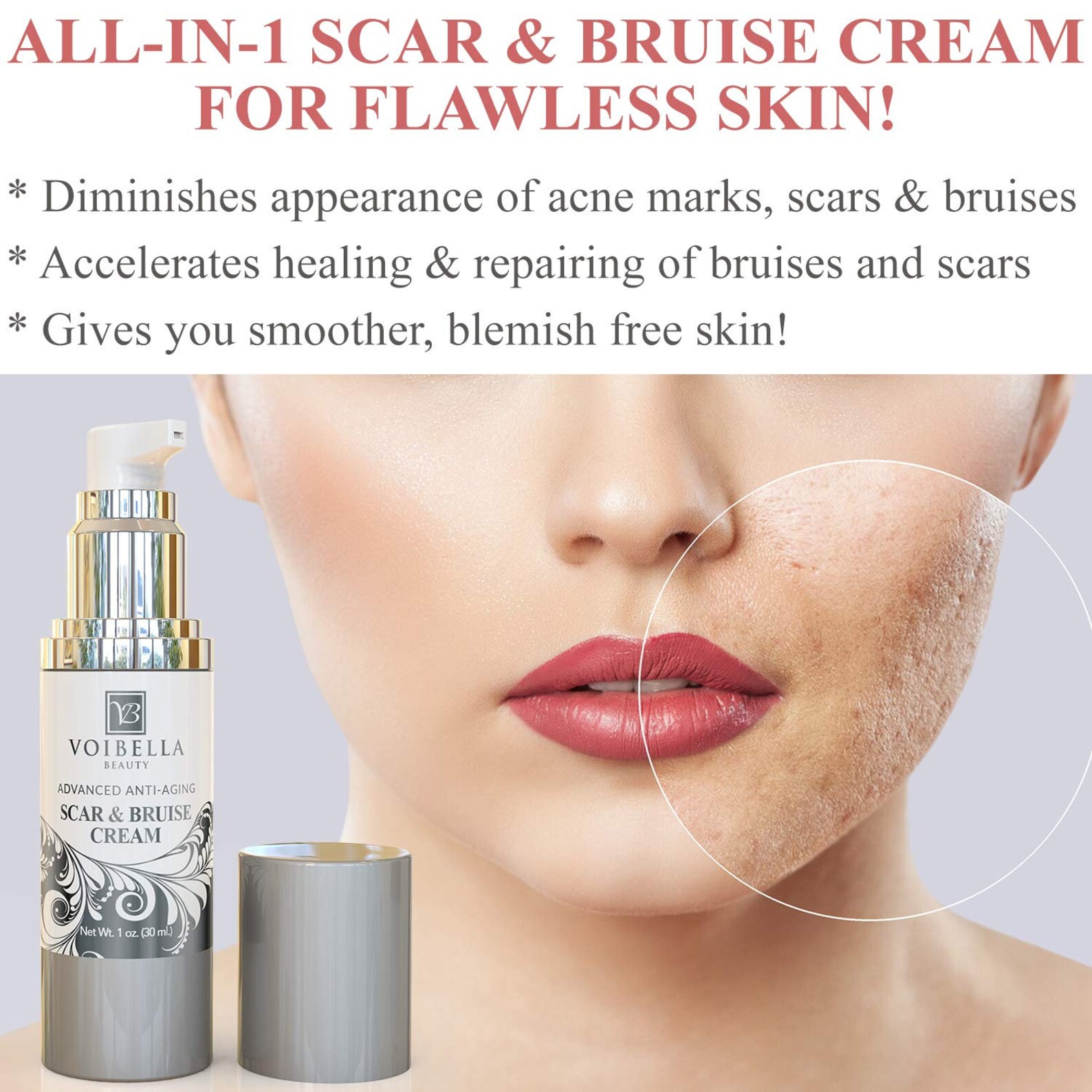 Scar and Bruise Removal Cream Best Treatment Remedy for Etsy