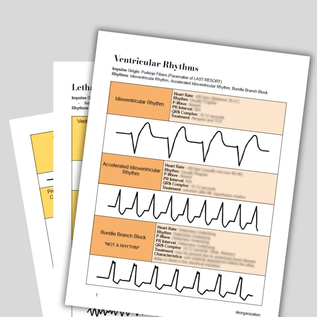 ECG Basics and Interpretation Bundle | Cheat Sheet | Nursing | NCLEX ...