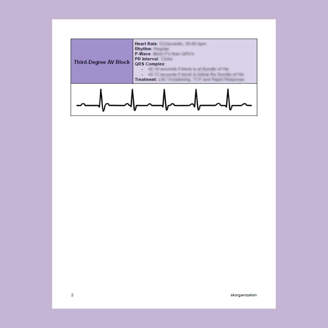AV Heart Blocks | ECG Basics | ECG Interpretation | Cheat Sheet ...