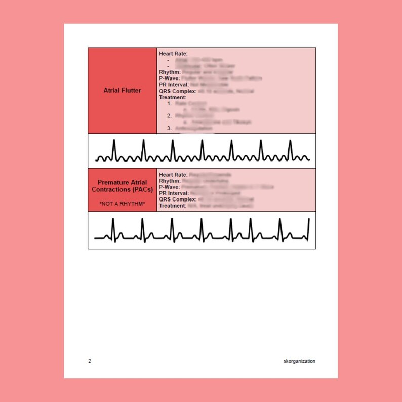 Complex Heart Rythms Atrial Rhythms | ECG Basics | ECG Interpretation | Cheat Sheet ...