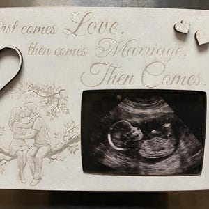 Sonogram Frame: Pregnancy Announcement, Ultrasound Display, Nursery Decoration