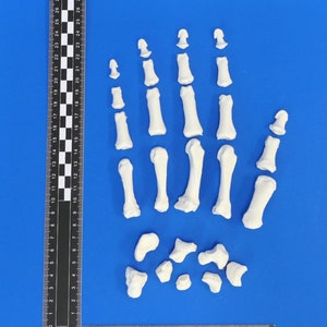 Könnte beinhalten: Ein Satz weißer Plastikknochen, die eine menschliche Hand darstellen. Die Knochen liegen auf einer blauen Oberfläche mit einem Lineal als Maßstab.