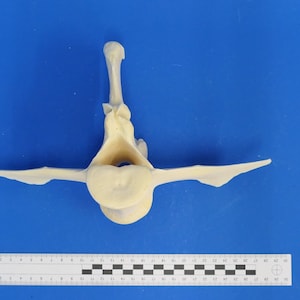 Op de afbeelding: Een lichtbeige anatomisch model van een menselijke wervel, waarschijnlijk een lendenwervel, met een prominente doornuitsteeksel en dwarsuitsteeksels. Het model bevindt zich op een blauwe ondergrond met een liniaal als schaal.