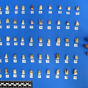 Dientes humanos reales. Dientes reales para decorar y hacer manualidades. Dientes para procesamiento de joyas, etc.