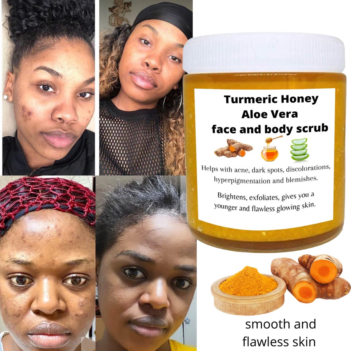 Turmeric aloe Vera and honey scrub dark spots remover smooth Etsy