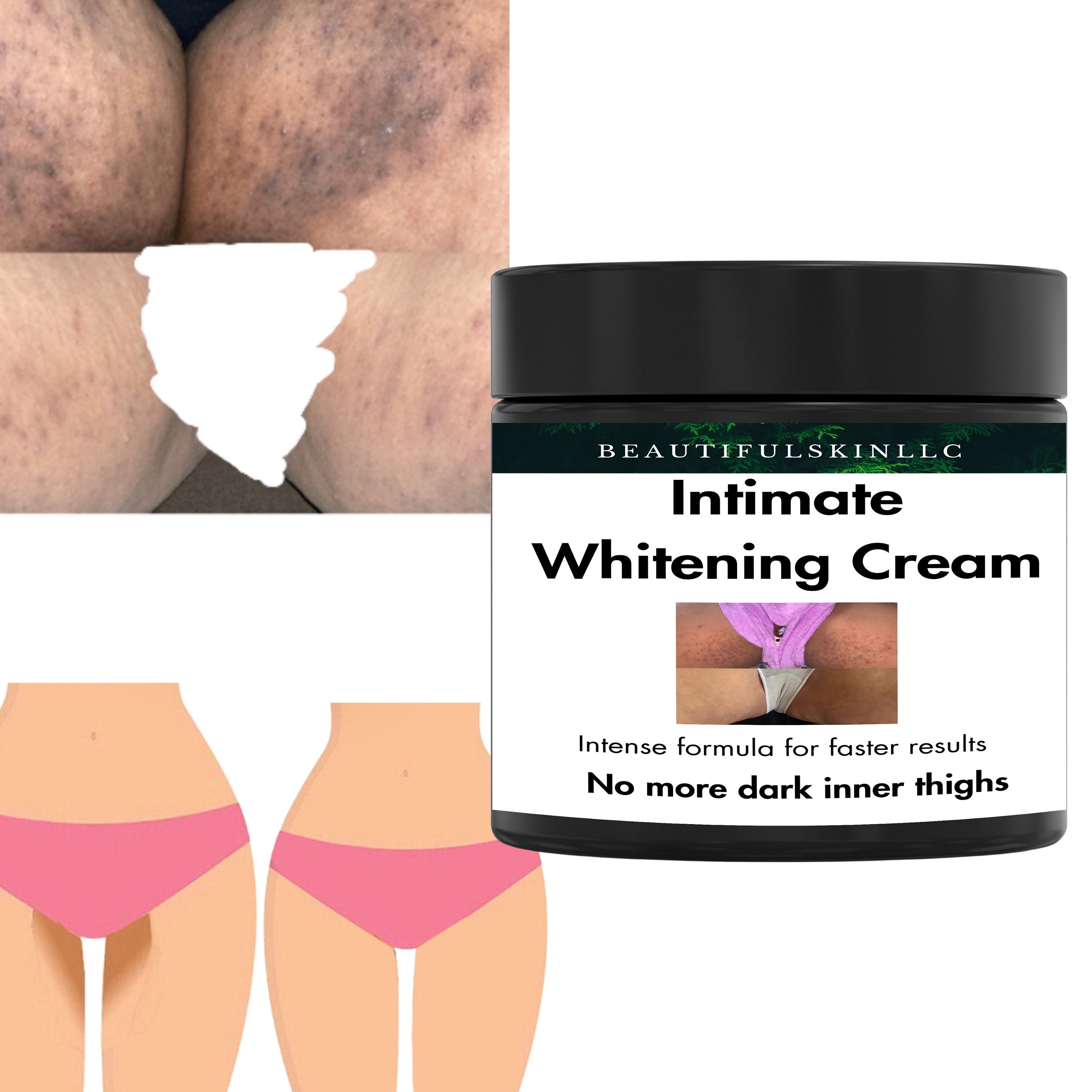 Intimate Brightening Cream Dark Inner Thighs Bikini Area