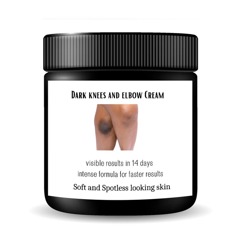 Dark Knees and Dark Elbows Lightening Cream Etsy