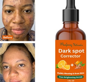 Dark Spot Corrector, Turmeric, Vitamin C, Glowing and Even Skin