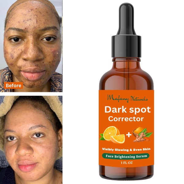 Dark Spot Corrector, Turmeric, Vitamin C, Glowing and Even Skin