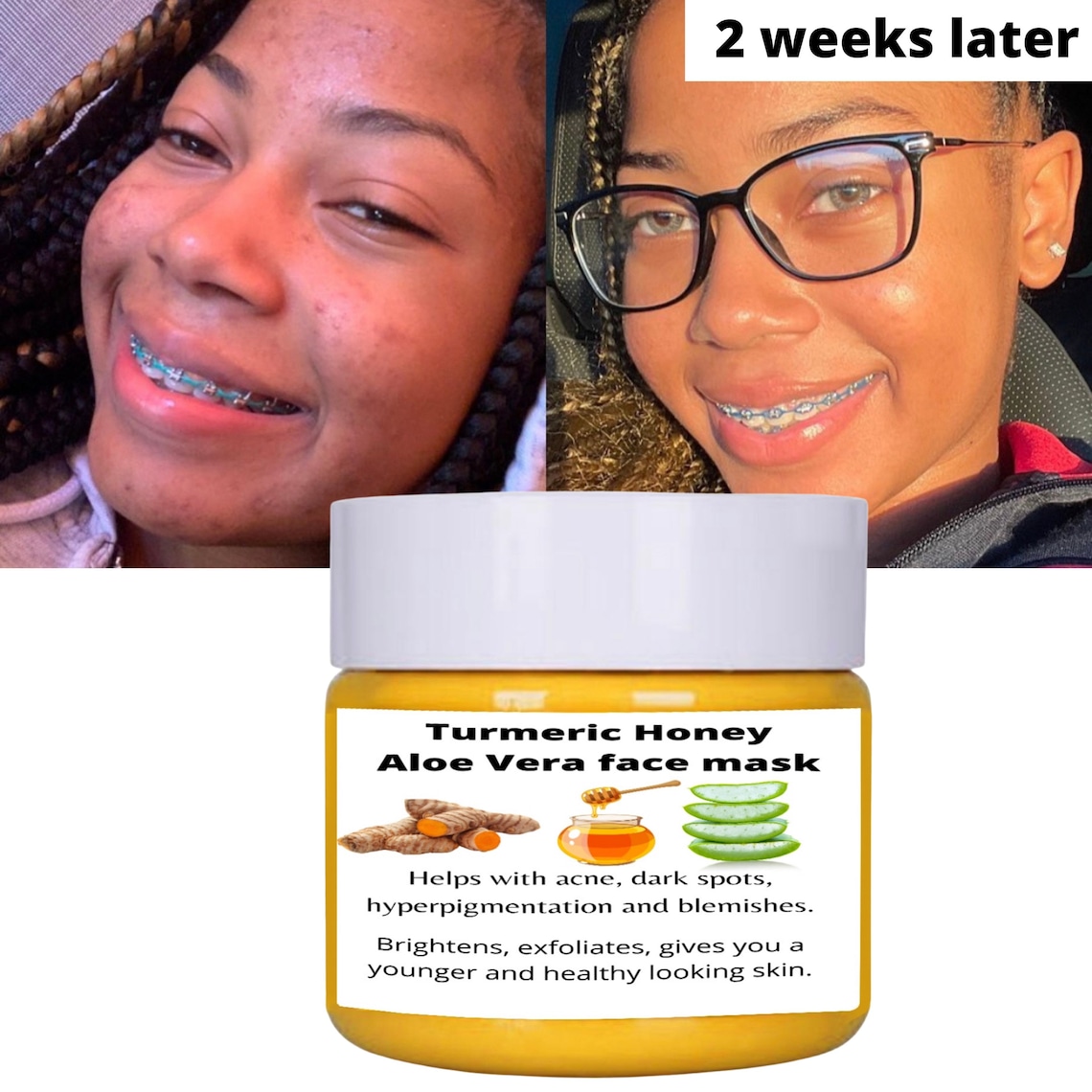Turmeric honey and aloe Vera face mask dark spots remover Etsy