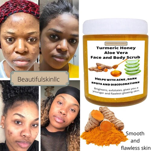 Turmeric Aloe Vera and Honey Scrub Dark Spots Remover Smooth Etsy