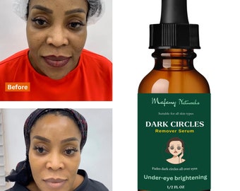 Under-eye brightening Serum for dark circles