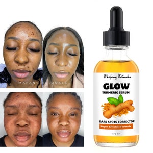 Turmeric Serum, Strong Brightening Serum, Dark spots, Blemish Serum, Even Glowing Skin