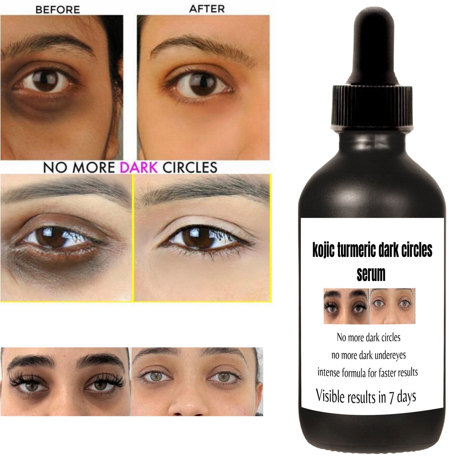 Dark circles serum under eyes lightening visible results in Etsy