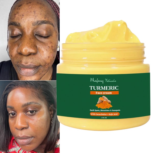 Turmeric Face Cream, Dark Spot Remover, Clearer, Smooth, Even Skin