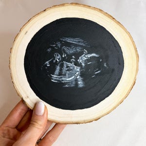 Custom Hand painted baby scan log slice keepsakes