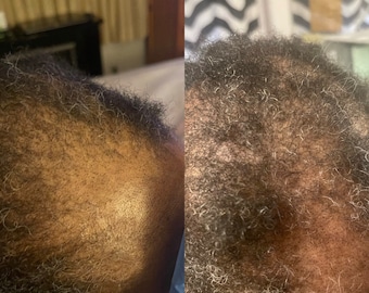 Ayurvedic Hair Mask/ Bhringraj Hair Growth Mask/ Black Hair Growth/ Deep Conditioner/ Castor Oil Mask/ Amla Hair Mask