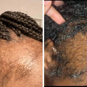 Amla Oil/ Bhringraj Oil/ Thick And Full Edges & Hair Growth Oil / Extra Strength Hair Growth Oil / Extreme Growth Oil /Ayurvedic Oil