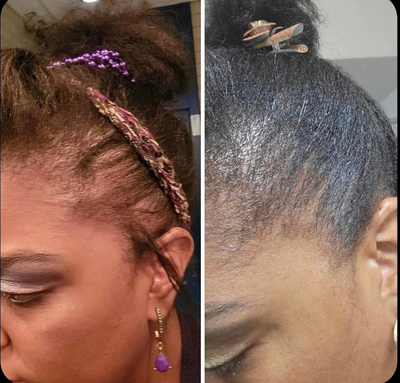 Hair Growth Oil Hair Growth Oil Wholesale Bulk Hair Growth Oil Private Label Hair Growth Oil