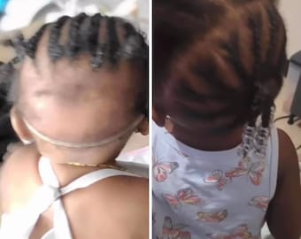 Kids Hair Growth Oil | Hair Growth Oil For Babies |Baby Hair Growth Oil | Hair Growth | Rosemary Hair Oil | Natural Hair Care for kids