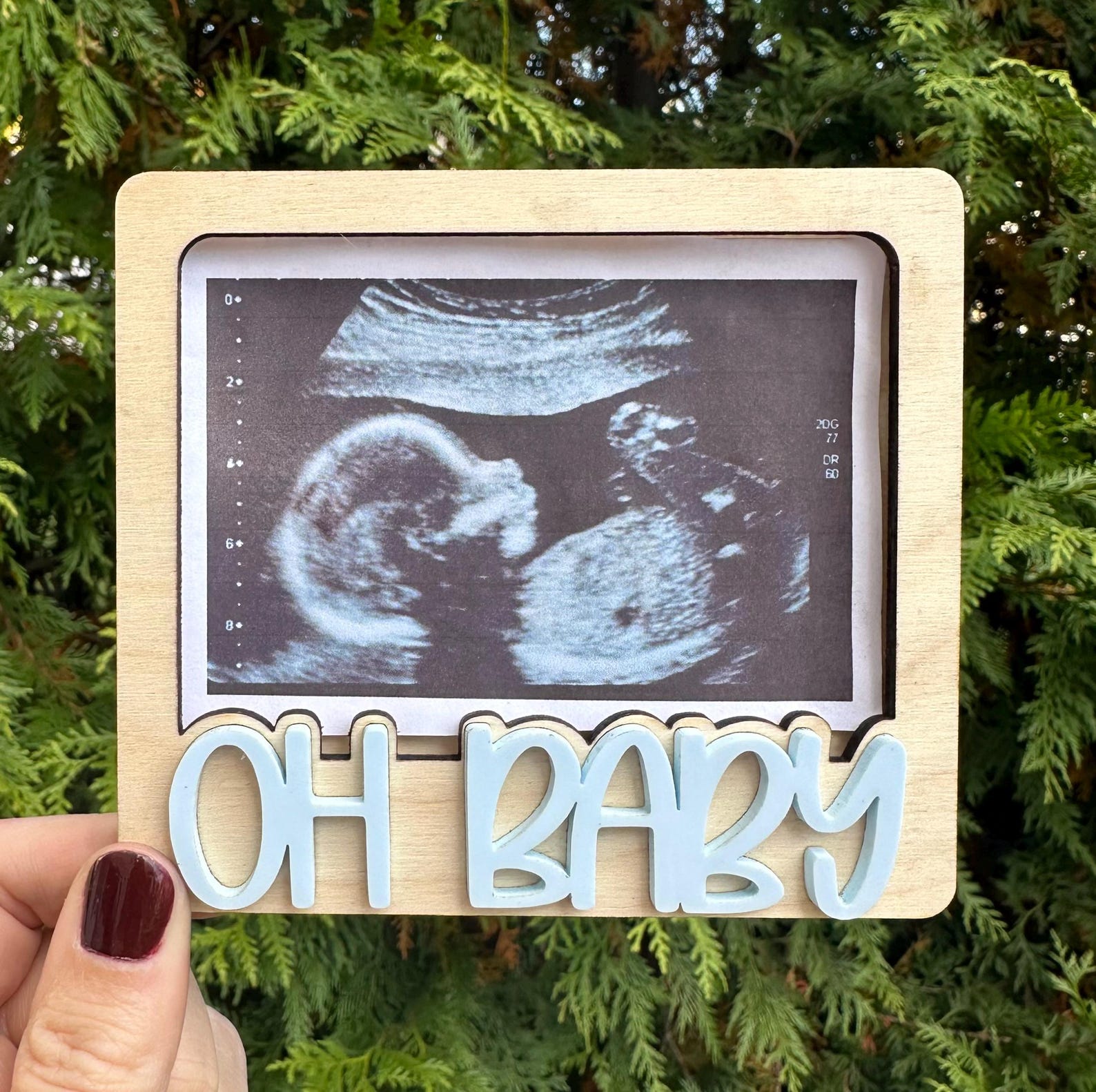 Sonogram Magnets Oh Baby Sonogram Fridge Magnet| Sonogram Frame| Ultrasound Frame| Baby ...