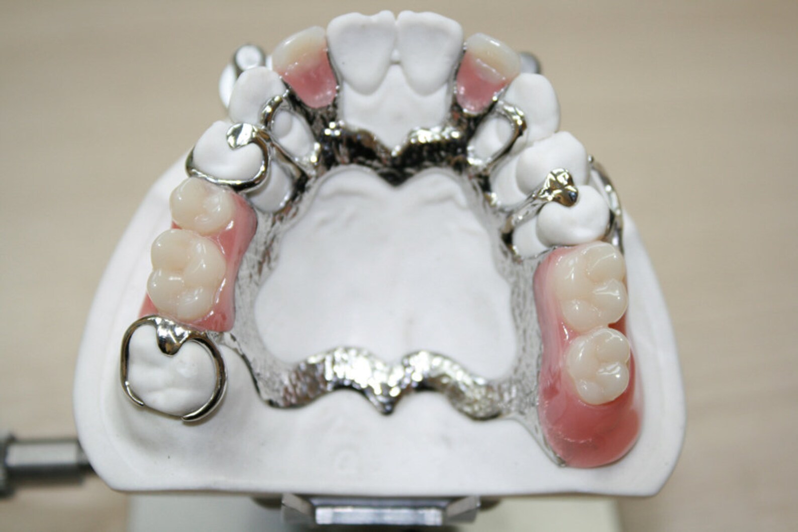 Money Back Guarantee Custom Cast Partial Denture Premium Etsy