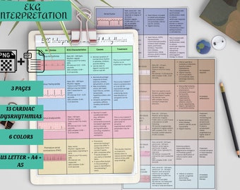 EKG & Dysrhythmia Interpretation | Cardiac Rhythm | Nursing School notes | Nursing Cardiac Study Guide | Nclex Notes | Nursing Student